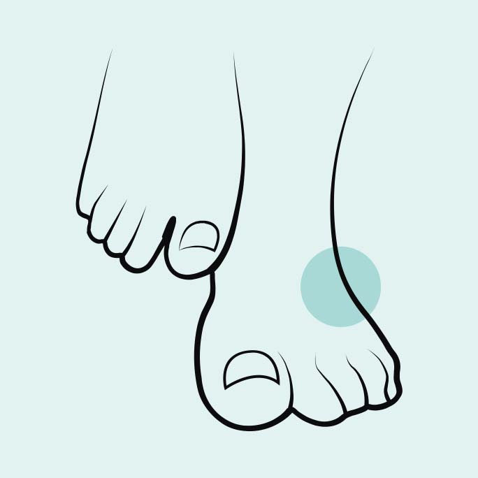 icon11-feet-symptoms