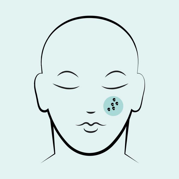 icon11-skin-symptoms