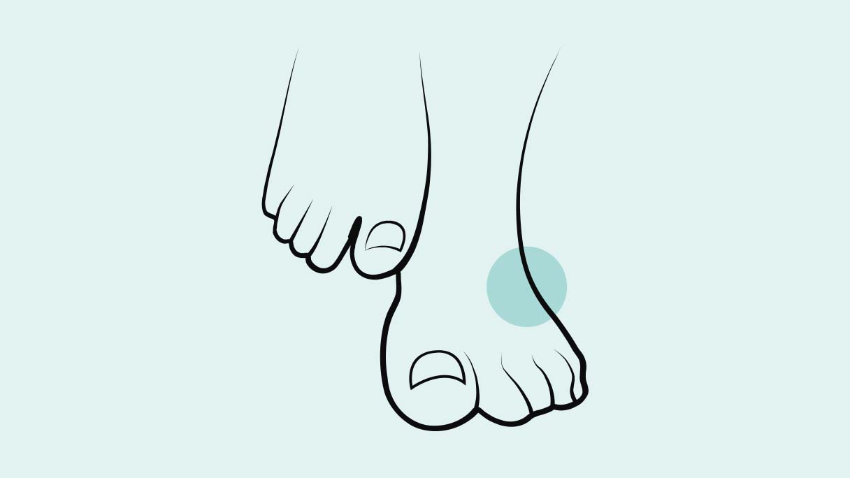  icon169-feet-symptoms