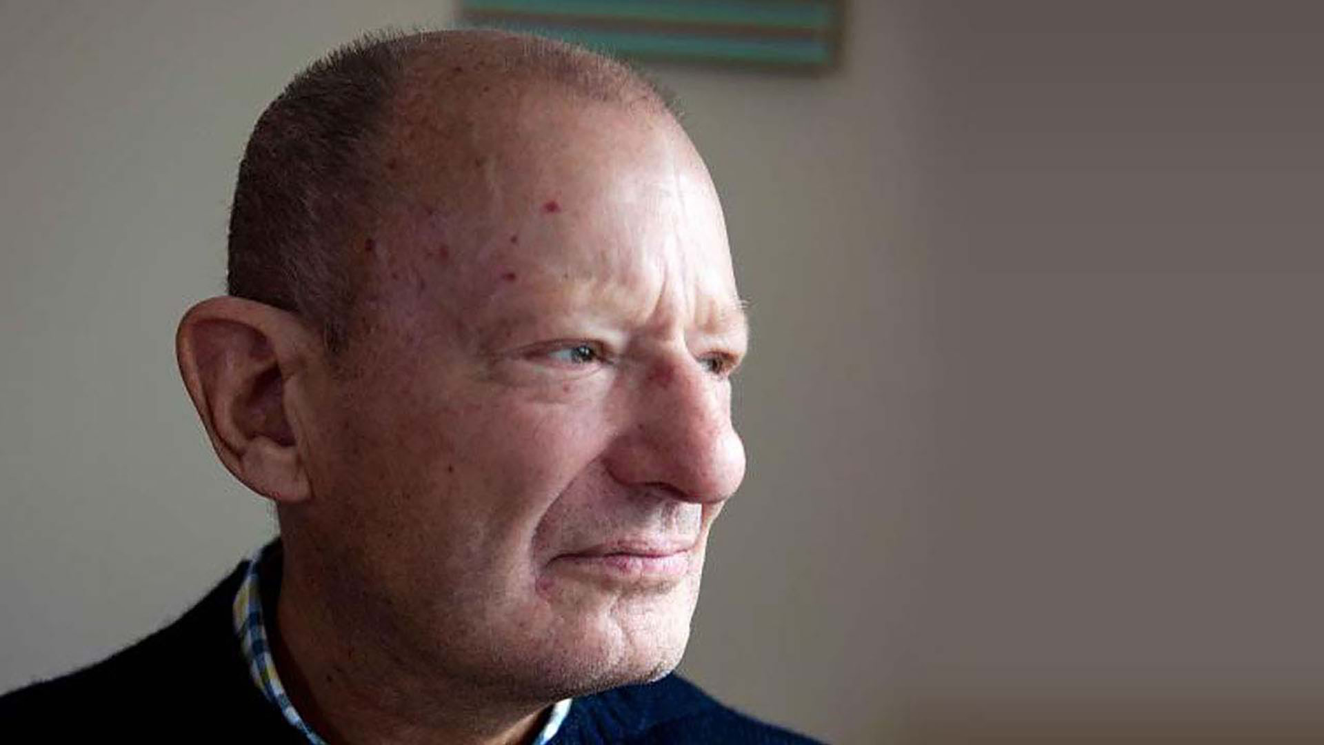 symptoms-skin_small_red_spots_telangiectasia