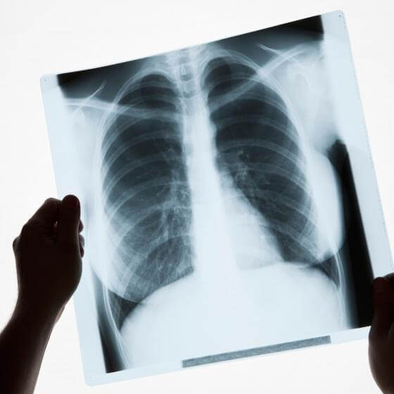 2-3-8-square-x-ray.jpg